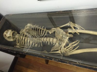 The Bizarre Skeletal Legacy of the Odd Fellows